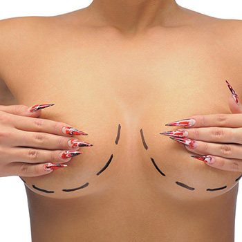 Chirurgie des seins